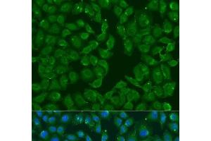 Immunofluorescence analysis of U2OS cells using MSRB3 Polyclonal Antibody at dilution of 1:100. (MSRB3 抗体)