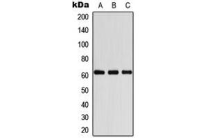 Western blot analysis of COASY expression in HeLa (A), A431 (B), Raw264. (COASY 抗体  (Center))