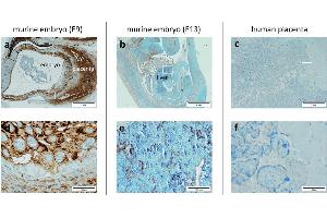 Immunohistochemical staining of PlGF in paraffin-embedded mouse placenta embryo (a and b) showing intense cytoplasmic staining in mouse placenta at E9. (PLGF 抗体  (AA 24-158))
