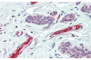 Detection of HBb in Human Breast Tissue using Polyclonal Antibody to Hemoglobin Beta (HBb) (Hemoglobin Subunit beta 抗体  (AA 1-147))