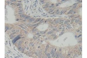 Immunohistochemistry (IHC) image for anti-ATP-Binding Cassette, Sub-Family B (MDR/TAP), Member 5 (ABCB5) (AA 570-808) antibody (ABIN7442258)