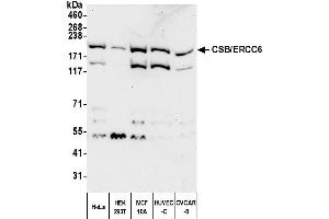 anti-Excision Repair Cross-Complementing Rodent Repair Deficiency, Complementation Group 6 (ERCC6) (AA 1-50) antibody