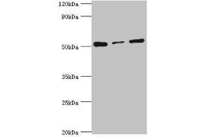 Western blot All lanes: Programmed cell death protein 4 antibody at 4 μg/mL Lane 1: Hela whole cell lysate Lane 2: MCF-7 whole cell lysate Lane 3: Jurkat whole cell lysate Secondary Goat polyclonal to rabbit IgG at 1/10000 dilution Predicted band size: 52, 51 kDa Observed band size: 52 kDa