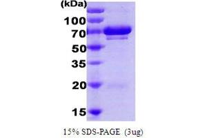 SDS-PAGE (SDS) image for Heat Shock 70kDa Protein 9 (Mortalin) (HSPA9) (AA 47-679) protein (His tag) (ABIN666870) (HSPA9 Protein (AA 47-679) (His tag))