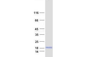 Western Blotting (WB) image for Presenilin Enhancer 2 Homolog (PSENEN) protein (Myc-DYKDDDDK Tag) (ABIN2728653)