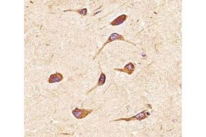 Immunohistochemical analysis of paraffin-embedded human brain section using FGFR2 antibody