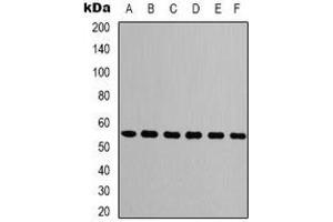 Western blot analysis of Beta-tubulin expression in A549 (A), mouse brain (B), rat brain (C), chicken lung (D), rabbit testis (E), sheep muscle  (F) whole cell lysates.