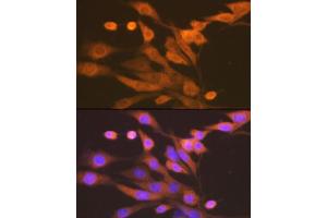 Immunofluorescence analysis of NIH-3T3 cells using Xanthine Oxidase (XDH) (XDH) Rabbit mAb (ABIN7271408) at dilution of 1:100 (40x lens). (XDH 抗体)