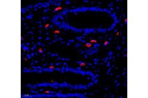 Immunofluorescence of paraffin embedded human colon using Annexin-A8 (ABIN7073071) at dilution of 1: 3866 (400x lens) (Annexin VIII 抗体)