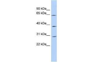 WB Suggested Anti-CCDC54 Antibody Titration: 0. (CCDC54 抗体  (N-Term))