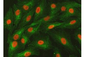 IF analysis of SMARCA2/BRM and Tubulin beta using anti-SMARCA2/BRM antibody (ABIN7601969) and anti-Tubulin beta antibody (ABIN7602744).