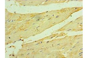 Immunohistochemistry of paraffin-embedded human skeletal muscle tissue using ABIN7154912 at dilution of 1:100 (HSPB2 抗体  (AA 1-182))