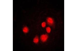 Immunofluorescent analysis of GADD153 staining in MCF7 cells. (DDIT3 抗体  (Center))