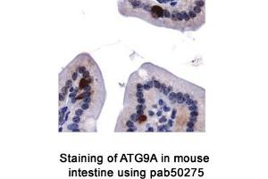 Image no. 2 for anti-ATG9 Autophagy Related 9 Homolog A (S. Cerevisiae) (ATG9A) (AA 750-839), (C-Term) antibody (ABIN363584) (ATG9A 抗体  (C-Term))