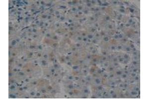 IHC-P analysis of Human Liver Tissue, with DAB staining. (Tissue factor 抗体  (AA 34-251))
