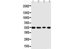 Anti-TRAF4 antibody, Western blotting Lane 1: Rat Thymus Tissue Lysate Lane 2: HELA Cell Lysate Lane 3: JURKAT Cell Lysate Lane 4: HEPA Cell Lysate (TRAF4 抗体  (C-Term))