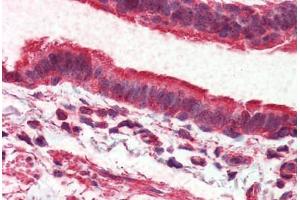 Lung, respiratory epithelium, Human: Formalin-Fixed, Paraffin-Embedded (FFPE) (ADGRV1 / GPR98 抗体  (Internal Region))