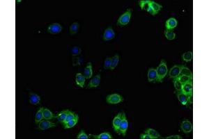 Immunofluorescent analysis of HepG2 cells using ABIN7143463 at dilution of 1:100 and Alexa Fluor 488-congugated AffiniPure Goat Anti-Rabbit IgG(H+L) (GGA1 抗体  (AA 1-89))