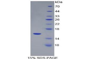 SDS-PAGE analysis of Human Renin Protein. (Renin Protein (REN))