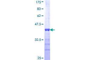 TOPBP1 Protein (AA 1327-1435) (GST tag)