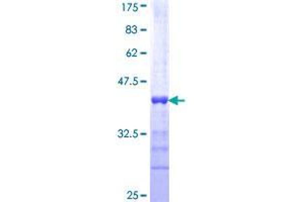 TOPBP1 Protein (AA 1327-1435) (GST tag)