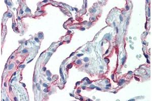 Human Lung (formalin-fixed, paraffin-embedded) stained with ICAM1 antibody ABIN462119 followed by biotinylated anti-mouse IgG secondary antibody ABIN481714, alkaline phosphatase-streptavidin and chromogen. (ICAM1 抗体)