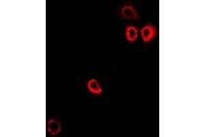 Immunofluorescent analysis of PTPS staining in MCF7 cells. (PTS 抗体)