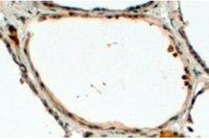 Immunohistochemistry (IHC) image for anti-Dual Oxidase 1 (DUOX1) (Internal Region) antibody (ABIN2465619) (DUOX1 抗体  (Internal Region))