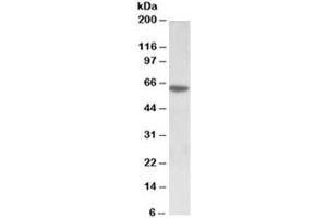 Western blot testing of MOLT4 lysate with SOX11 antibody at 0. (SOX11 抗体)