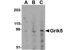Western blot analysis of Grik5 in human brain tissue lysate with AP30386PU-N Grik5 antibody at (A) 0.