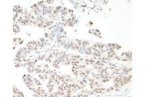 Immunohistochemistry (IHC) image for anti-Interleukin enhancer-binding factor 3 (ILF3) (AA 456-506) antibody (ABIN7453567) (Interleukin enhancer-binding factor 3 (ILF3) (AA 456-506) 抗体)