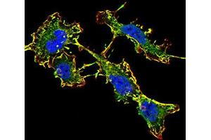 Immunofluorescence (IF) image for anti-Glutamate Receptor, Ionotropic, N-Methyl D-Aspartate 2B (GRIN2B) (AA 27-163) antibody (ABIN5611338)