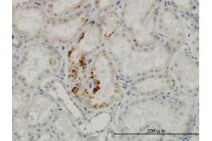 Image no. 2 for anti-Endothelial Cell-Specific Molecule 1 (ESM1) (AA 85-185) antibody (ABIN466176) (ESM1 抗体  (AA 85-185))