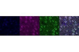 Immunohistochemistry (IHC) image for anti-Ubiquitin Carboxyl-terminal Esterase L1 (Ubiquitin Thiolesterase) (UCHL1) antibody (ABIN7456167) (UCHL1 抗体)