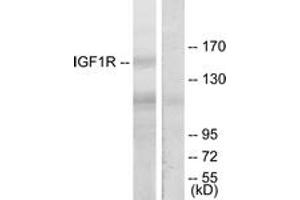 Western blot analysis of extracts from 293 cells, treated with Insulin, using IGF1R (Ab-1165/1166) Antibody. (IGF1R 抗体  (AA 1131-1180))