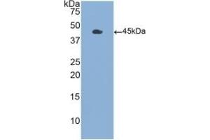 Detection of Recombinant GMCSF, Human using Polyclonal Antibody to Colony Stimulating Factor 2, Granulocyte Macrophage (GM-CSF) (GM-CSF 抗体  (AA 18-144))