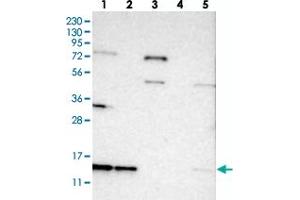 Western blot analysis of Lane 1: RT-4, Lane 2: U-251 MG, Lane 3: Human Plasma, Lane 4: Liver, Lane 5: Tonsil with SNRPD3 polyclonal antibody  at 1:250-1:500 dilution. (SNRPD3 抗体)