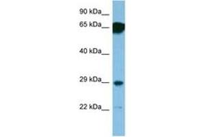 Image no. 1 for anti-Small Nuclear Ribonucleoprotein Polypeptide N (SNRPN) (AA 46-95) antibody (ABIN6746188) (SNRPN 抗体  (AA 46-95))