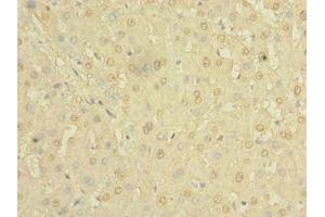 Immunohistochemistry of paraffin-embedded human liver tissue using ABIN7154980 at dilution of 1:100 (Hemoglobin, epsilon 1 (HBe1) (AA 2-147) 抗体)