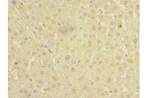 Immunohistochemistry of paraffin-embedded human liver tissue using ABIN7154980 at dilution of 1:100 (Hemoglobin, epsilon 1 (HBe1) (AA 2-147) 抗体)