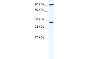 WB Suggested Anti-PAntibody Titration:  0. (PARP16 抗体  (N-Term))