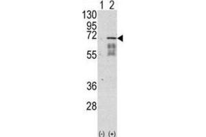 Western Blotting (WB) image for anti-Activin Receptor Type I (ACRV1) antibody (ABIN3002992) (ACVR1 抗体)