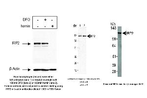 Image no. 5 for anti-Iron-Responsive Element Binding Protein 2 (IREB2) antibody (ABIN363497) (IREB2 抗体)