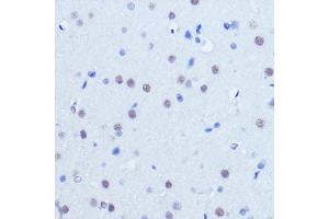 Immunohistochemistry of paraffin-embedded mouse brain using PI Rabbit pAb (ABIN6128450, ABIN6145596, ABIN6145597 and ABIN6221297) at dilution of 1:25 (40x lens). (PIAS2 抗体  (AA 483-572))