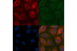 EIF5 Mouse Monoclonal Antibody staining Hela cells by IF/ICC. (EIF5 抗体  (C-Term))
