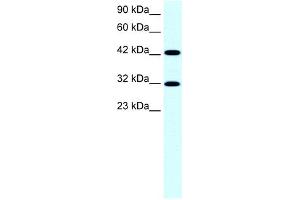WB Suggested Anti-GTF2H2 Antibody Titration:  0. (GTF2H2 抗体  (Middle Region))