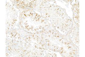 Immunohistochemistry (IHC) image for anti-Tubulin, beta (TUBB) (AA 1-50) antibody (ABIN7453995)