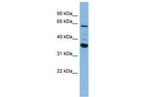 Image no. 1 for anti-Cytochrome P450, Family 3, Subfamily A, Polypeptide 7 (CYP3A7) (C-Term) antibody (ABIN6741776) (CYP3A7 抗体  (C-Term))