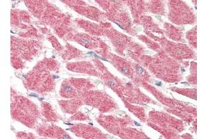 Human Heart (formalin-fixed, paraffin-embedded) stained with LGI4at 5 µg/ml followed by biotinylated goat anti-rabbit IgG secondary antibody, alkaline phosphatase-streptavidin and chromogen. (LGI4 抗体)