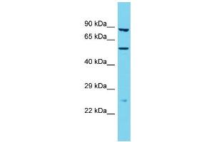 Western Blotting (WB) image for anti-Transmembrane Protease, Serine 9 (TMPRSS9) (N-Term) antibody (ABIN2790876) (TMPRSS9 抗体  (N-Term))